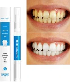 BOR Tanden Bleekpen - Tanden Bleken - Tandenbleekset - Whitening Pen - Tandenblekers - Wittere Tanden - Teeth Whitening Pen - Tanden Bleker -Verzorgingsproducten Verkoop 1031x1200 2