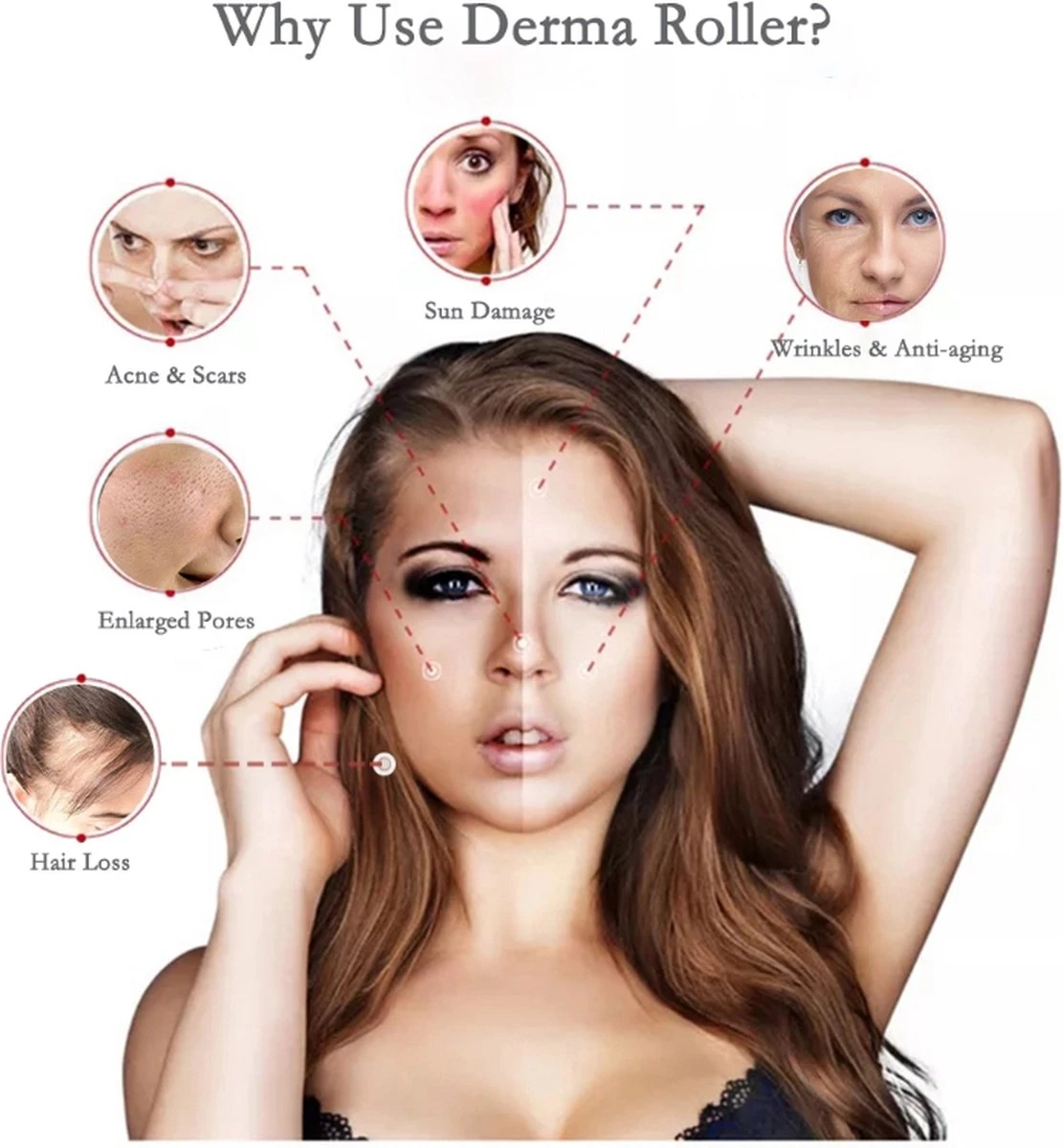 Dermaroller 1.5 Mm Met Cleaning Spray - 540 Naalden - Steriel Verpakt - Hoge Kwaliteit Chirurgisch Staal - Bewezen Effectief Tegen Rimpels, Acne Littekens, En Cellulitis & Stimulatie Van Haargroei Op De Hoofdhuid, Baardgroei 5 Dermaroller 1.5 Mm Met Cleaning Spray - 540 Naalden - Steriel Verpakt - Hoge Kwaliteit Chirurgisch Staal - Bewezen Effectief Tegen Rimpels, Acne Littekens, En Cellulitis & Stimulatie Van Haargroei Op De Hoofdhuid, Baardgroei - Afbeelding 3