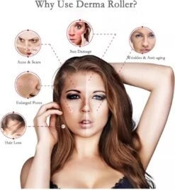 Dermaroller 0.5 Mm & Desinfectie Alcohol Spray - 540 Naalden - Steriel Verpakt -Verzorgingsproducten Verkoop 1111x1200 2