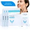 ISmile Professionele Tandenbleekset - Veilig Tanden Bleken - Zonder Peroxide - Witte Tanden - Teeth Whitening -Verzorgingsproducten Verkoop 1152x1200