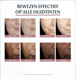 Eucerin Anti-Pigment Nachtcrème - 50 Ml -Verzorgingsproducten Verkoop 1157x1200 9