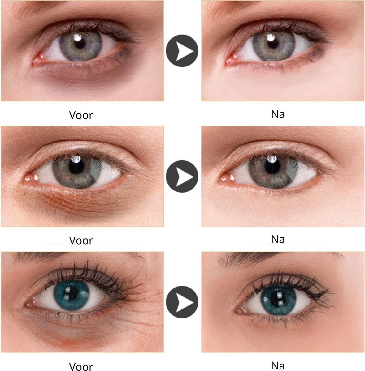 Merkloos LANBENA - Collageen Oogmasker - 24K Goud Oog Masker Patch - 60 Stuks (30 Paar) - Wallen En Donkere Kringen Wegwerken - Anti Age 5 Merkloos LANBENA - Collageen Oogmasker - 24K Goud Oog Masker Patch - 60 Stuks (30 Paar) - Wallen En Donkere Kringen Wegwerken - Anti Age - Afbeelding 3