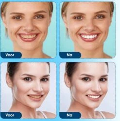 Diamond White - Teeth Whitening Strips - 28x Strips - Zonder Peroxide (0%) - Tandenbleekset - Tandenbleek Strips – Mint -Verzorgingsproducten Verkoop 1185x1200 2