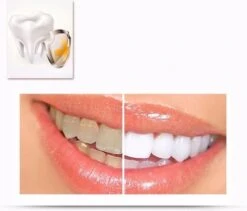 Merkloos Tanden Whitener Pen - Professionele Tandenbleek Gel - Tandenbleker 10 Merkloos Tanden Whitener Pen - Professionele Tandenbleek Gel - Tandenbleker -Verzorgingsproducten Verkoop 1200x1026 1