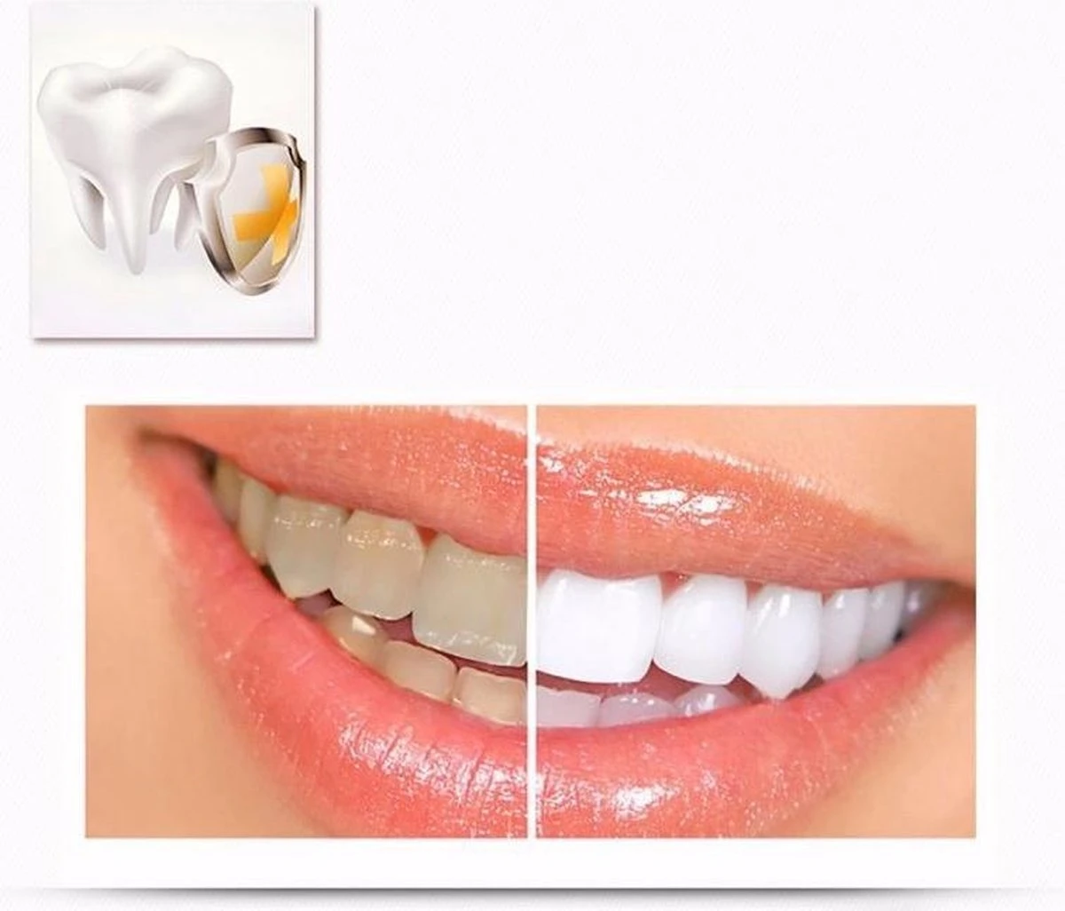 Merkloos Tanden Whitener Pen - Professionele Tandenbleek Gel - Tandenbleker 5 Merkloos Tanden Whitener Pen - Professionele Tandenbleek Gel - Tandenbleker - Afbeelding 3