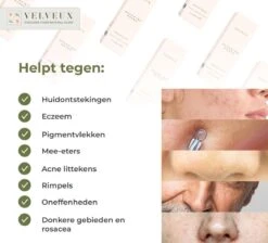 Gezichtsolie 50ML - Hydraterende Kalmerende Rozenolie 100% Vegan - Arganolie - Vitamine C Serum - Serum Gezichtsverzorging - Rozenbottel Olie Rosehip Oil - Skincare - Valentijnsdag Cadeau -Verzorgingsproducten Verkoop 1200x1088 3