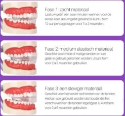 Edoir Rechte Tanden Beugel - Retainer Voor Rechte Tanden - Rechte Tanden Bitje -Verzorgingsproducten Verkoop 1200x1109