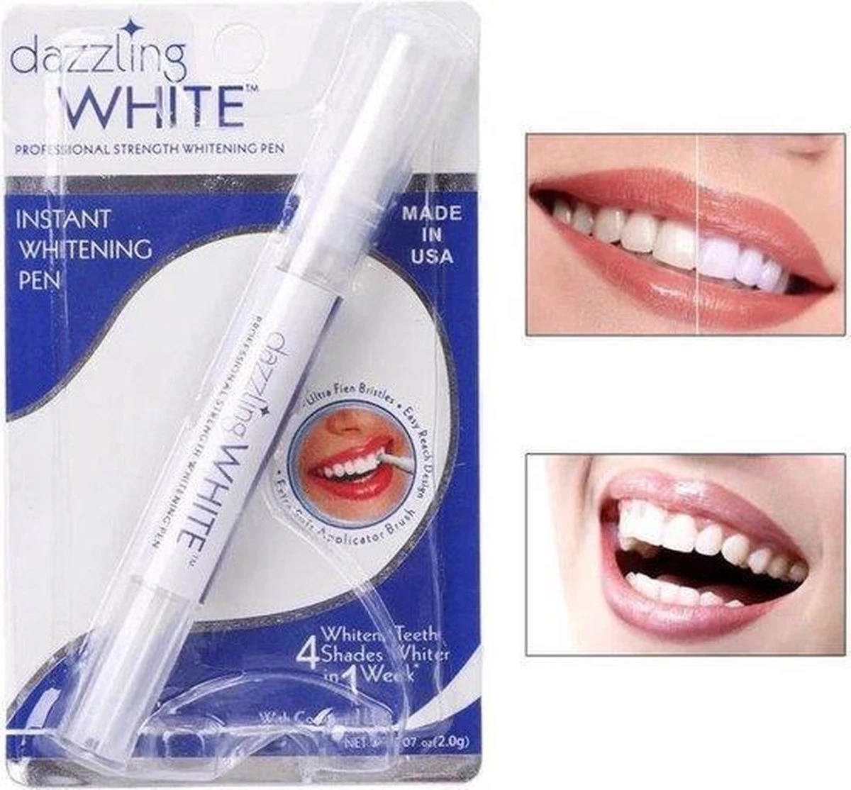 Merkloos Tanden Whitener Pen - Professionele Tandenbleek Gel - Tandenbleker 3 Merkloos Tanden Whitener Pen - Professionele Tandenbleek Gel - Tandenbleker