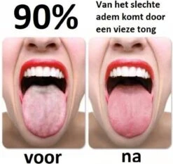 Effectieve Tongschraper (hoge Kwaliteit) - Tongreiniger Koper - Mondverzorging - Persoonlijke Verzorging – Rose Gold - Underdog Tech 5 Effectieve Tongschraper (hoge Kwaliteit) - Tongreiniger Koper - Mondverzorging - Persoonlijke Verzorging – Rose Gold - Underdog Tech -Verzorgingsproducten Verkoop 1200x1130 2