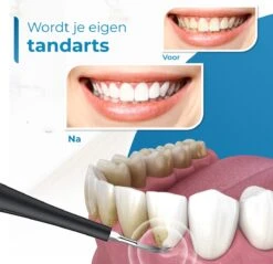 Professionele Tandsteen Verwijderaar - 5 Standen - Inclusief Tandarts Set - Met 3 Opzetstukken - Elektrisch - Tandplak -Verzorgingsproducten Verkoop 1200x1163