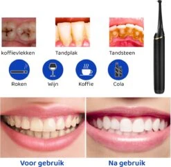 ExCorn Elektrische Tandsteen Verwijderaar - Inclusief 6-delig Tandartsset - 3 Standen - Elektrisch Tandplak Verwijderen - Tanden Polijsten 15 ExCorn Elektrische Tandsteen Verwijderaar - Inclusief 6-delig Tandartsset - 3 Standen - Elektrisch Tandplak Verwijderen - Tanden Polijsten -Verzorgingsproducten Verkoop 1200x1173