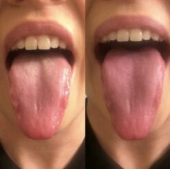 Orabrush Tongreiniger -Verzorgingsproducten Verkoop 1200x1197 4