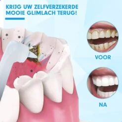 DEN-T® PRO P350 Elektrische Tandenpolijster - Wit - 5 Standen - 5 Opzetstukken - Polijstmachine - Polijstset - Tanden Polijsten - 14 DEN-T® PRO P350 Elektrische Tandenpolijster - Wit - 5 Standen - 5 Opzetstukken - Polijstmachine - Polijstset - Tanden Polijsten - -Verzorgingsproducten Verkoop 1200x1200 152