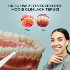 Merkloos Tandsteen Verwijderaar Elektrisch – Tandenborstel Opzetstukken - Tandarts Spiegel - 5 Standen -Wit -Verzorgingsproducten Verkoop 1200x1200 252