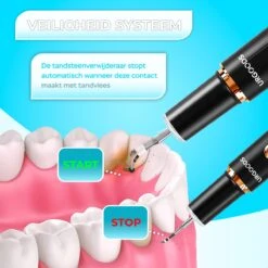 Tandsteen Verwijderaar Set - Elektrisch - Sonisch - Draadloos - Tandplak Verwijderen - Wit -Verzorgingsproducten Verkoop 1200x1200 259