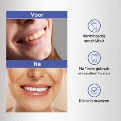 Merkloos Tanden Bleken Met 14 Sets Whitening Strips - Tandenbleekset Met Bamboe Tandenborstel - Tanden Bleekstrips -Verzorgingsproducten Verkoop 1200x1200 396