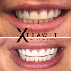 Xtrawit - Teeth Whitening Strips - Tandenbleekset - Wittere Tanden - Goedgekeurde Tandenbleek Strips - 30 Strips 12 Xtrawit - Teeth Whitening Strips - Tandenbleekset - Wittere Tanden - Goedgekeurde Tandenbleek Strips - 30 Strips -Verzorgingsproducten Verkoop 1200x1200 406