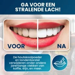 Tandenbleekset - Teeth Whitening - Teeth Whitener - Wittere Tanden - Tanden Bleken - Direct Resultaat - Zelfde Effect Als Whitening Strips -Verzorgingsproducten Verkoop 1200x1200 410