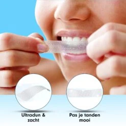 Diamond White - Teeth Whitening Strips - 28x Strips - Zonder Peroxide (0%) - Tandenbleekset - Tandenbleek Strips – Mint -Verzorgingsproducten Verkoop 1200x1200 437