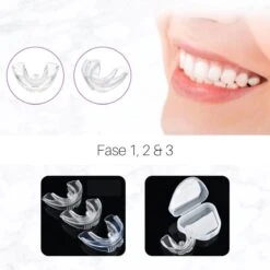 Edoir Rechte Tanden Beugel - Retainer Voor Rechte Tanden - Rechte Tanden Bitje -Verzorgingsproducten Verkoop 1200x1200 458