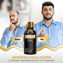 BeautyFit - Haargroei Serum - Haargroei Versneller - Inclusief Scalp Massager En Ebook - Haargroei Producten Mannen Vrouwen - Biotine - Haar Versneller - Beschadigd Haar - Haar Vitamines -Verzorgingsproducten Verkoop 1200x1200 625