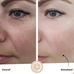 Vitamine C Serum Van Vicius® - Gezichtsverzorging Met Hyaluronzuur - Acne - Serum Gezicht - Anti Aging - 30ML -Verzorgingsproducten Verkoop 1200x1200 651