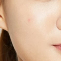 Merkloos COSRX Acne Pimple Master Package Set 4 Packs Of 24 Patches 19 Merkloos COSRX Acne Pimple Master Package Set 4 Packs Of 24 Patches -Verzorgingsproducten Verkoop 1200x1200 809