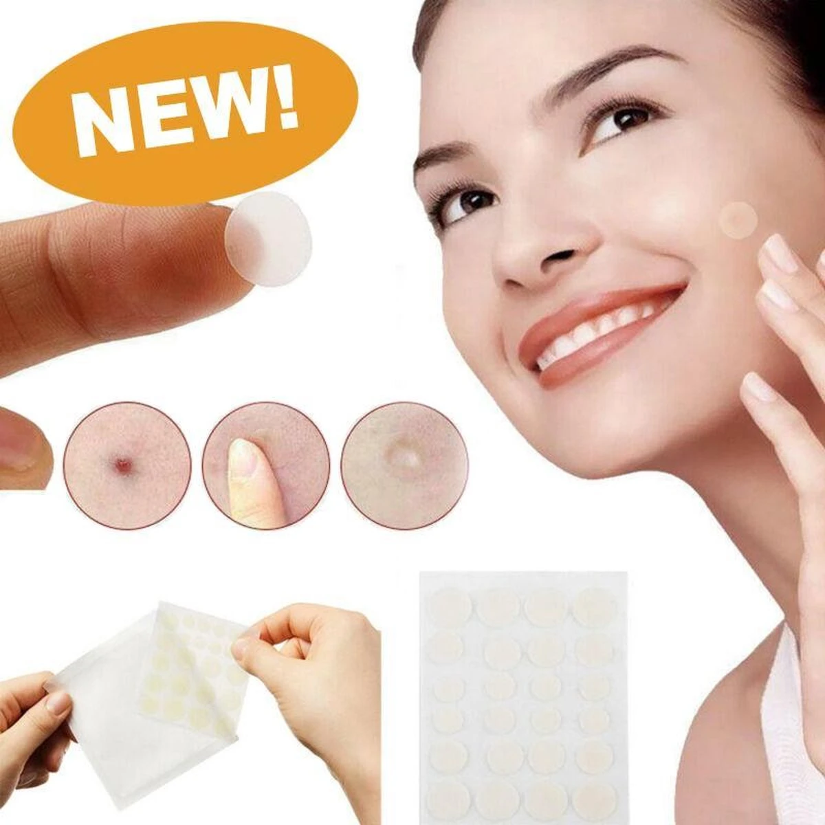Merkloos Pimple Patch - Acne Patch - Puisten Patch - Acne Sticker - Puisten Pleister - Pimple Patches - Acne Pleister - Puisten Verwijderaar - Puisten Creme - Acne Verwijderen Set - Acneverzorging | 36 Stuks & Directe Levering 3 Merkloos Pimple Patch - Acne Patch - Puisten Patch - Acne Sticker - Puisten Pleister - Pimple Patches - Acne Pleister - Puisten Verwijderaar - Puisten Creme - Acne Verwijderen Set - Acneverzorging | 36 Stuks & Directe Levering