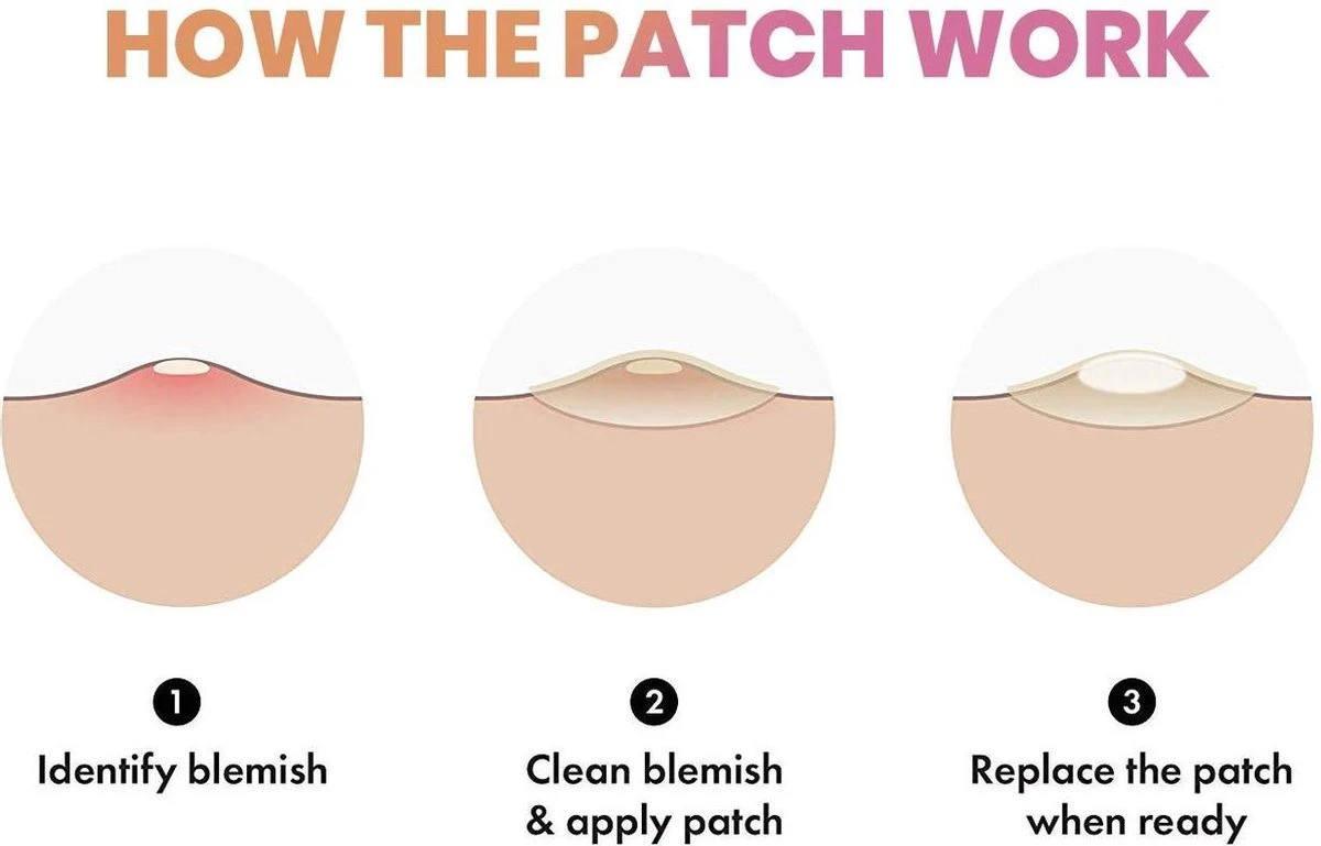 Merkloos Pimple Patch - Acne Patch - Puisten Patch - Acne Sticker - Puisten Pleister - Pimple Patches - Acne Pleister - Puisten Verwijderaar - Puisten Creme - Acne Verwijderen Set - Acneverzorging | 36 Stuks & Directe Levering 6 Merkloos Pimple Patch - Acne Patch - Puisten Patch - Acne Sticker - Puisten Pleister - Pimple Patches - Acne Pleister - Puisten Verwijderaar - Puisten Creme - Acne Verwijderen Set - Acneverzorging | 36 Stuks & Directe Levering - Afbeelding 4