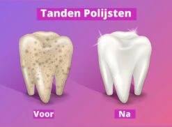 Merkloos HQ Tooth Polisher - Tanden Polijsten - Wittere Tanden - Tandsteen Tandplak Verwijderaar - Elektrisch -Verzorgingsproducten Verkoop 1200x886 3