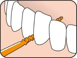 Tepe EasyPick Oranje Maat XS/S – 36 Stuks -Verzorgingsproducten Verkoop 1200x897