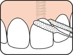 Tepe Floss Bridge & Implant 30 St -Verzorgingsproducten Verkoop 1200x899 1