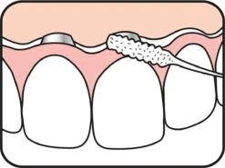 Tepe Floss Bridge & Implant 30 St -Verzorgingsproducten Verkoop 1200x901 1