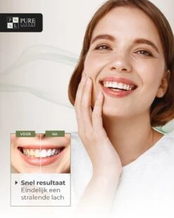 Tandenbleekset INCL. 14 Whitening Strips En 6 Gelpennen - ZONDER PEROXIDE - Teeth Whitening Kit - Tandenbleekset Met Ebook En Nederlandse Handleiding - Tandenblekers - Valentijnsdag Cadeau 18 Tandenbleekset INCL. 14 Whitening Strips En 6 Gelpennen - ZONDER PEROXIDE - Teeth Whitening Kit - Tandenbleekset Met Ebook En Nederlandse Handleiding - Tandenblekers - Valentijnsdag Cadeau -Verzorgingsproducten Verkoop 960x1200 3