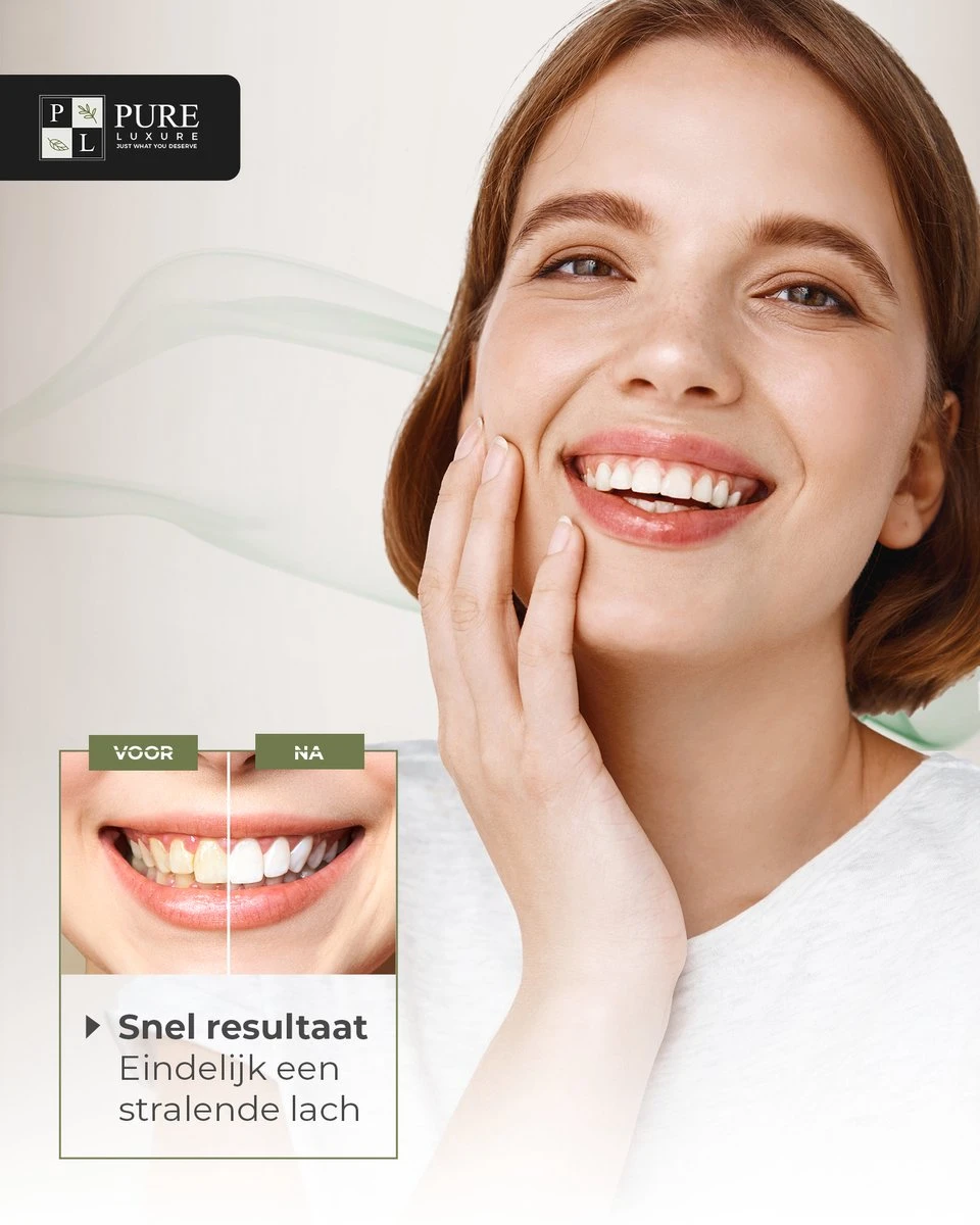 Tandenbleekset INCL. 14 Whitening Strips En 6 Gelpennen - ZONDER PEROXIDE - Teeth Whitening Kit - Tandenbleekset Met Ebook En Nederlandse Handleiding - Tandenblekers - Valentijnsdag Cadeau 8 Tandenbleekset INCL. 14 Whitening Strips En 6 Gelpennen - ZONDER PEROXIDE - Teeth Whitening Kit - Tandenbleekset Met Ebook En Nederlandse Handleiding - Tandenblekers - Valentijnsdag Cadeau - Afbeelding 6