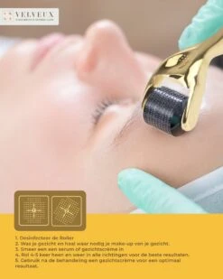 Dermaroller – 540 Micro Naalden – 0.5 MM Needle – Huidverjonging – Huidverzorging – Littekens – Striea – Steriel Verpakt -Verzorgingsproducten Verkoop 960x1200 30